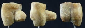 Romain - Fragment de statuette en marbre (Bassin de femme) - 100 / 200 ap. J.-C.
